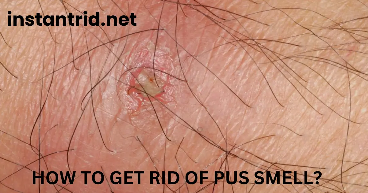 how to get rid of pus smell